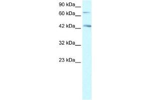 WB Suggested Anti-SEMA4A Antibody Titration: 1. (Sema4a anticorps  (N-Term))