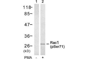 Western blot analysis of extracts from 293 cells untreated(lane 1) or treated with PMA(lane 2) using Rac1(Phospho-Ser71) Antibody. (RAC1 anticorps  (pSer71))
