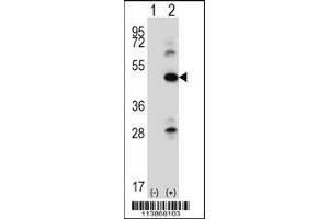 Western blot analysis of ILK using rabbit polyclonal ILK Antibody (pS246) using 293 cell lysates (2 ug/lane) either nontransfected (Lane 1) or transiently transfected (Lane 2) with the ILK gene. (ILK anticorps  (AA 225-253))