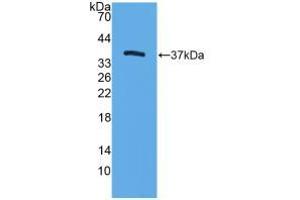 Western blot analysis of recombinant Mouse TFF3. (TFF3 anticorps  (AA 23-81))