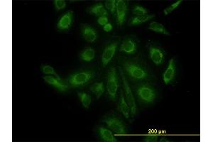 Immunofluorescence of monoclonal antibody to ACTR3 on HeLa cell. (ACTR3 anticorps  (AA 1-418))