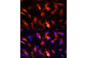 Immunofluorescence analysis of C6 cells using RNF149 Polyclonal Antibody (ABIN7270062) at dilution of 1:100 (40x lens). (RNF149 anticorps  (AA 221-400))