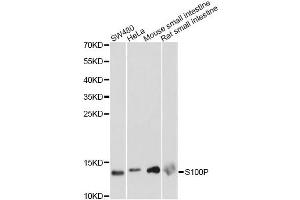 Western blot analysis of extracts of various cell lines, using S100P antibody. (S100P anticorps)