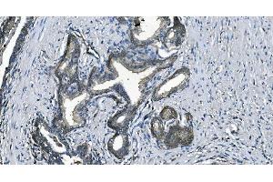 IHC analysis of EEF2/Elongation factor 2 using anti-EEF2/Elongation factor 2 antibody (ABIN7603142). (EEF2 anticorps  (N-Term))
