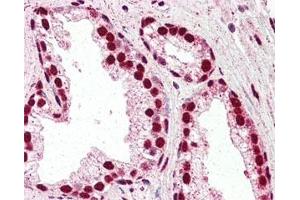 IHC staining of FFPE human prostate tissue with IRF6 antibody at 2. (IRF6 anticorps)