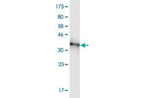 Western Blot detection against Immunogen (37. (RBM5 anticorps  (AA 75-184))