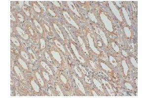 anti-Insulin-Like Growth Factor antibody