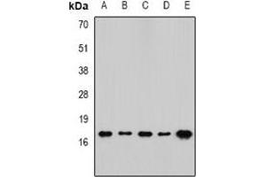 Western blot analysis of RPLP1 expression in SW480 (A), mouse spleen (B), mouse brain (C), rat lung (D), rat liver (E) whole cell lysates. (RPLP1 anticorps)
