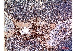Immunohistochemistry (IHC) analysis of paraffin-embedded Human Lymph, antibody was diluted at 1:100.