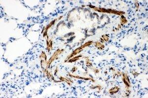 IHC-P: ATP2A2 antibody testing of rat lung tissue (ATP2A2 anticorps  (N-Term))