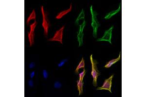 ABIN6257051 and ABIN6274616 staining Hela cells by IF/ICC. (CDCA3 anticorps  (C-Term))
