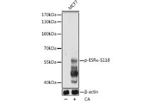 Western blot analysis of extracts of MCF7 cells, using Phospho-ESRα-S118 pAb  at 1:1000 dilution. (Estrogen Receptor alpha anticorps  (pSer118))