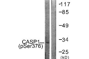 Immunohistochemistry analysis of paraffin-embedded human brain tissue using Caspase 1 (Phospho-Ser376) antibody. (Caspase 1 anticorps  (pSer376))