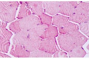 Anti-PTPRA antibody IHC staining of human skeletal muscle.