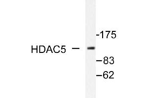 Image no. 1 for anti-Histone Deacetylase 5 (HDAC5) antibody (ABIN271892)