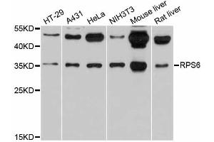 Western blot analysis of extracts of various cell lines, using RPS6 antibody (ABIN5973596) at 1/1000 dilution. (RPS6 anticorps)