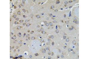 Immunohistochemistry of paraffin-embedded Rat brain using AURKC Polyclonal Antibody