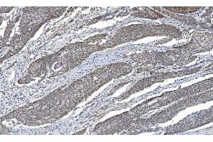 IHC analysis of HDAC5 using anti-HDAC5 antibody (ABIN7599922). (HDAC5 anticorps  (AA 13-1107))