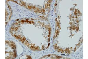 Immunoperoxidase of monoclonal antibody to DAZ1 on formalin-fixed paraffin-embedded human testis.