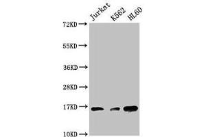 Western Blot Positive WB detected in: Jurkat whole cell lysate, K562 whole cell lysate, HL60 whole cell lysate All lanes: HIST1H3A antibody at 1:500 Secondary Goat polyclonal to rabbit IgG at 1/40000 dilution Predicted band size: 16 kDa Observed band size: 16 kDa (HIST1H3A anticorps  (3meLys27))
