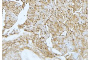 ABIN6277269 at 1/100 staining Mouse muscle tissue by IHC-P. (FLIP anticorps  (Internal Region))