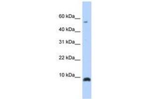 Image no. 1 for anti-Chemokine (C-X-C Motif) Ligand 6 (CXCL6) (C-Term) antibody (ABIN6740256) (CXCL6 anticorps  (C-Term))