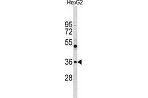 Western blot analysis of ELOVL2 (arrow) in HepG2 cell line lysates (35ug/lane) using ELOVL2  Antibody (N-term). (ELOVL2 anticorps  (N-Term))