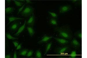 Immunofluorescence of monoclonal antibody to MAPKAPK2 on HeLa cell.
