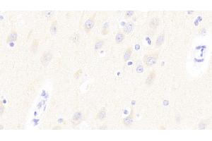 Detection of GP6 in Human Cerebrum Tissue using Polyclonal Antibody to Glycoprotein VI (GP6) (GP6 anticorps  (AA 86-231))