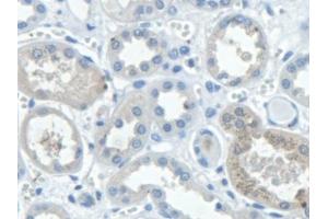 Detection of STAM2 in Human Kidney Tissue using Polyclonal Antibody to Signal Transducing Adaptor Molecule 2 (STAM2)