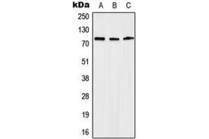 Western blot analysis of Anosmin expression in Jurkat (A), mouse heart (B), rat heart (C) whole cell lysates. (Anosmin anticorps  (Center))