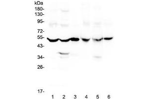Western blot testing of rat 1) brain, 2) liver, 3) small intestine and mouse 4) brain, 5) liver and 6) small intestine lysate with GDA antibody at 0.