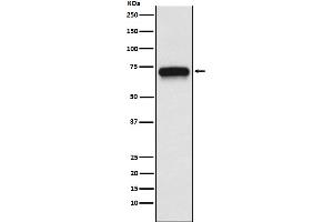 Western blot analysis of ACHA4 expression in SH-SY5Y cell lysate.