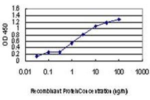 Detection limit for recombinant GST tagged ULK1 is approximately 0. (ULK1 anticorps  (AA 602-715))