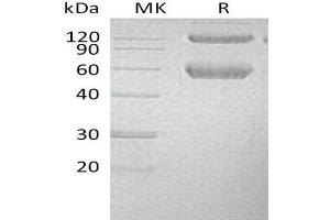 Western Blotting (WB) image for Bone Morphogenetic Protein Receptor 1A (BMPR1A) protein (His tag,Fc Tag) (ABIN7320751)