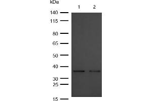 All lanes : OXGR1 Rabbit mAb at 1/1k dilution Lane 1 : Mouse Kidney lysates Lane 2 : Rat Spleen lysates Lysates/proteins at 20 μg per lane. (Recombinant OXGR1 anticorps)