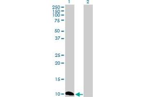 Western Blot analysis of CSTB expression in transfected 293T cell line by CSTB MaxPab polyclonal antibody. (CSTB anticorps  (AA 1-98))