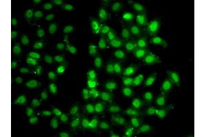 Immunofluorescence analysis of U20S cell using PSMD8 antibody. (PSMD8 anticorps)