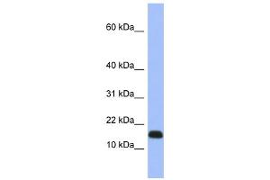 WB Suggested Anti-RPL37A Antibody Titration: 0. (RPL37A anticorps  (Middle Region))