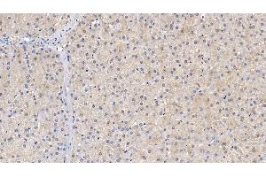 Detection of SOD1 in Human Liver Tissue using Polyclonal Antibody to Superoxide Dismutase 1 (SOD1) (SOD1 anticorps  (AA 2-154))