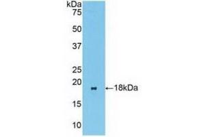 Detection of Recombinant BCL2L11, Human using Polyclonal Antibody to Bcl2 Like Protein 11 (BCL2L11)