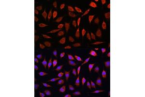 Immunofluorescence analysis of L929 cells using ZIP8 Rabbit pAb (ABIN6131079, ABIN6147995, ABIN6147996 and ABIN6214638) at dilution of 1:100.