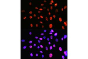 Immunofluorescence analysis of C6 cells using DNA topoisomerase I (DNA topoisomerase I (TOP1)) Rabbit mAb (ABIN7270850) at dilution of 1:100 (40x lens).