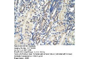 Rabbit Anti-EIF4E2 Antibody  Paraffin Embedded Tissue: Human Kidney Cellular Data: Epithelial cells of renal tubule Antibody Concentration: 4. (EIF4E2 anticorps  (N-Term))