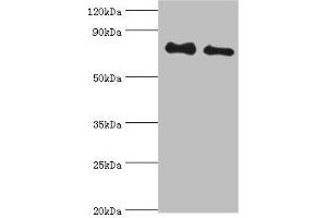 Western blot All lanes: Cytoplasmic tyrosine-protein kinase BMX antibody at 4 μg/mL Lane 1: A549 whole cell lysate Lane 2: Mouse heart tissue Secondary Goat polyclonal to rabbit IgG at 1/10000 dilution Predicted band size: 78 kDa Observed band size: 78 kDa