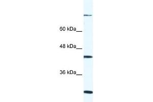 WB Suggested Anti-FGD1 Antibody Titration: 0. (FGD1 anticorps  (C-Term))