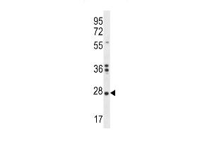 NKAIN1 Antibody (C-term) (ABIN656410 and ABIN2845704) western blot analysis in K562 cell line lysates (35 μg/lane).