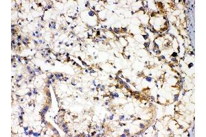 IHC analysis of APOL1 using anti-APOL1 antibody (ABIN7600725).