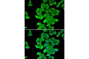 Immunofluorescence analysis of HeLa cell using SMYD2 antibody. (SMYD2A anticorps)