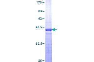 Image no. 1 for Transient Receptor Potential Cation Channel, Subfamily C, Member 4 Associated Protein (TRPC4AP) (AA 341-451) protein (GST tag) (ABIN1323822)